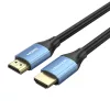 Vention 1,5m 4K 60Hz HDMI Kábel (ALHSG)